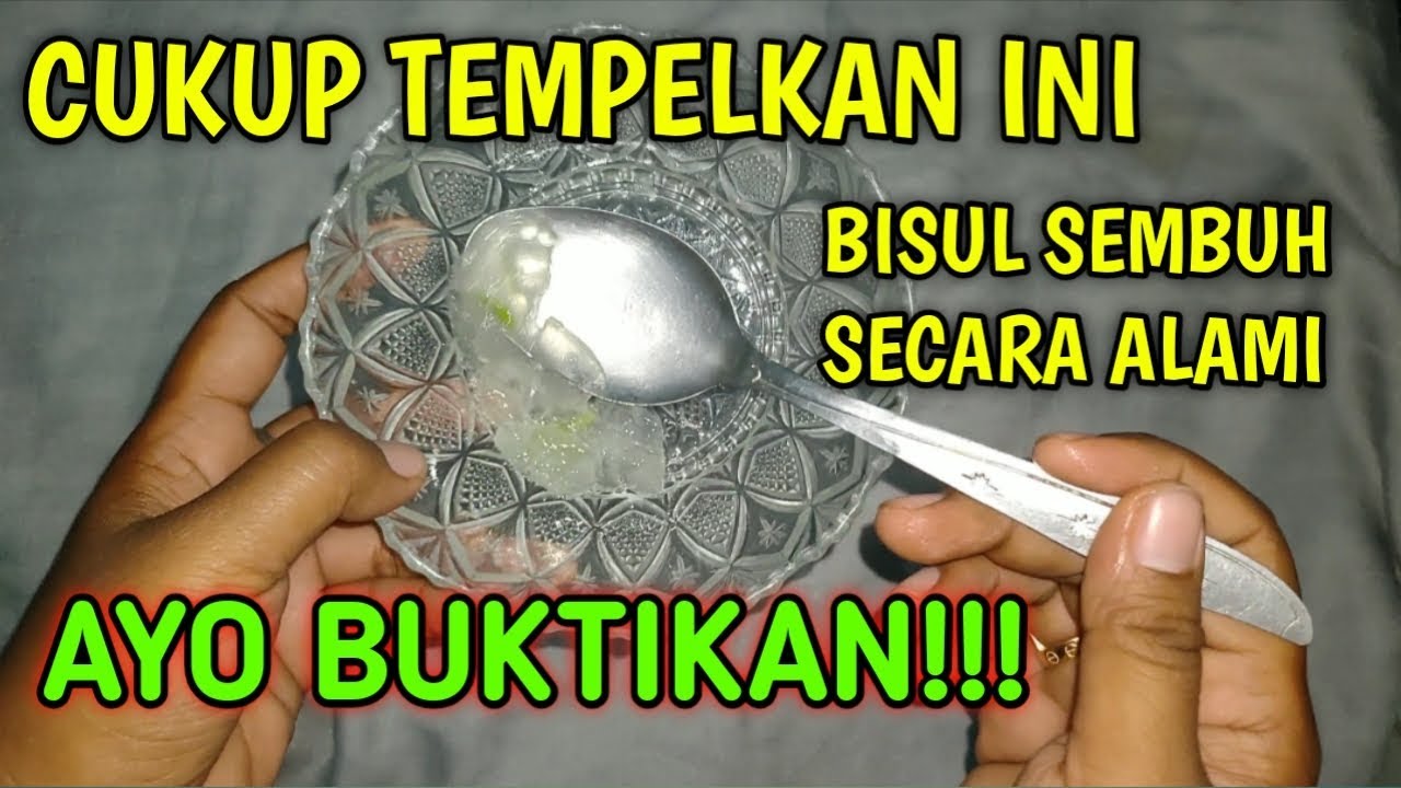 Cara ampuh, Menyembuhkan bisul dengan cepat || Cara mengobati bisul