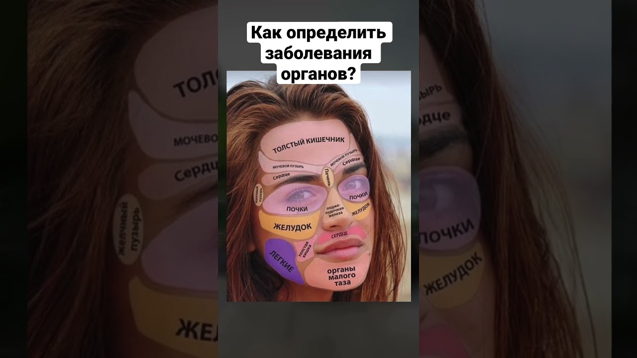 Откуда прыщи и высыпания на лице? Как определить заболевание органов? #здоровье #питание