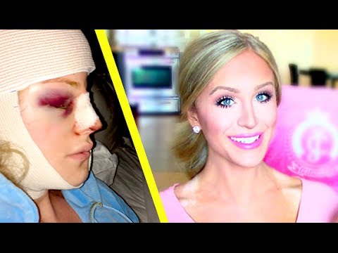 My Facial Plastic Surgery Story | Gigi