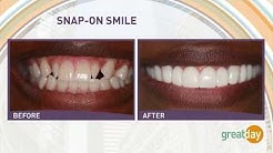 Houston Cosmetic Dentist...SNAP-ON SMILE..Changing lives the affordable way:) 