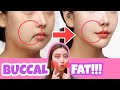 Buccal Fat Removal Exercise & Massage | Reduce Cheek Fat, Chubby Cheeks (No Surgery!💕)