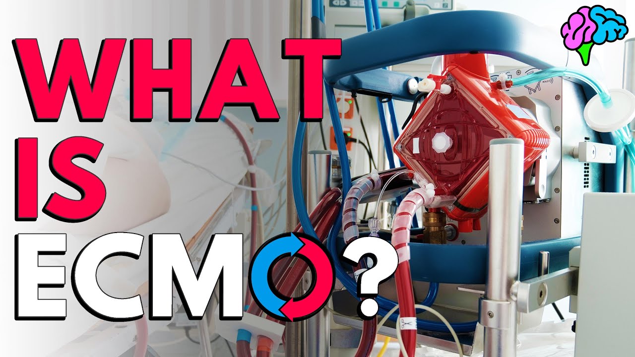 Ecmo what is ECMO: How