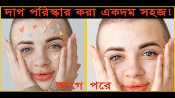 How to Quickly Smooth Skin and Remove Dark Spots, Blemishes & Scars Easily Photoshop Tutorial