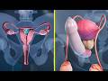 Come funzionano i metodi contraccettivi femminili e maschili e quali sono i più efficaci