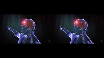 Cerebral Palsy Alliance 3D (2014) - CSU Animation & Visual Effects