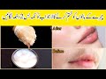 Flawless facial hair removal home remedy  unwanted facial hair  skin whitening home remedies 