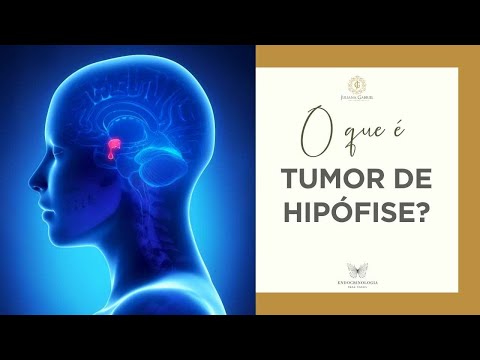 Vídeo: Microadenoma Hipofisário - Causas, Sintomas, Tratamento