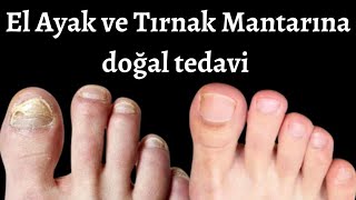 TIRNAK VE AYAK MANTARINA VEDA EDİN | EVDE KOLAYLIKLA HAZIRLAYACAĞINIZ DOĞAL VE ETKİLİ MANTAR KREMİ