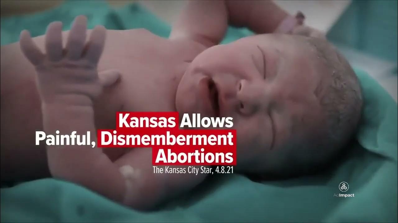 2022 Kansas Abortion Amendment PRO YES PAC TV Ad 2 Value Them Both