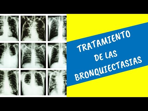 Bronquiectasias ¿Cuál es el tratamiento correcto?