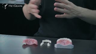 Complete dentures with HeyGears materials: separate denture and base plate