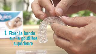 ETAPE 2 : Assemblage et mise en place de l'orthèse d'avancée mandibulaire Quies®
