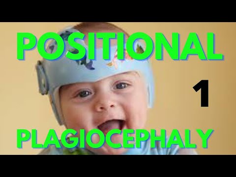 What is Positional or Deformational Plagiocephaly/Symptoms,/Diagnosis/Treatment 1st part