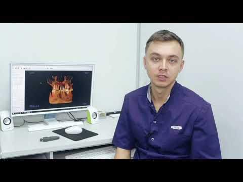 Как сэкономить на  имплантации зубов при 99,9   результате. Новейшее от Штрауманн.