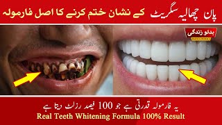 TEETH WHITENING | How to Remove Teeth Stains  Pan Cigarette K Nishan Brown Stain Remover