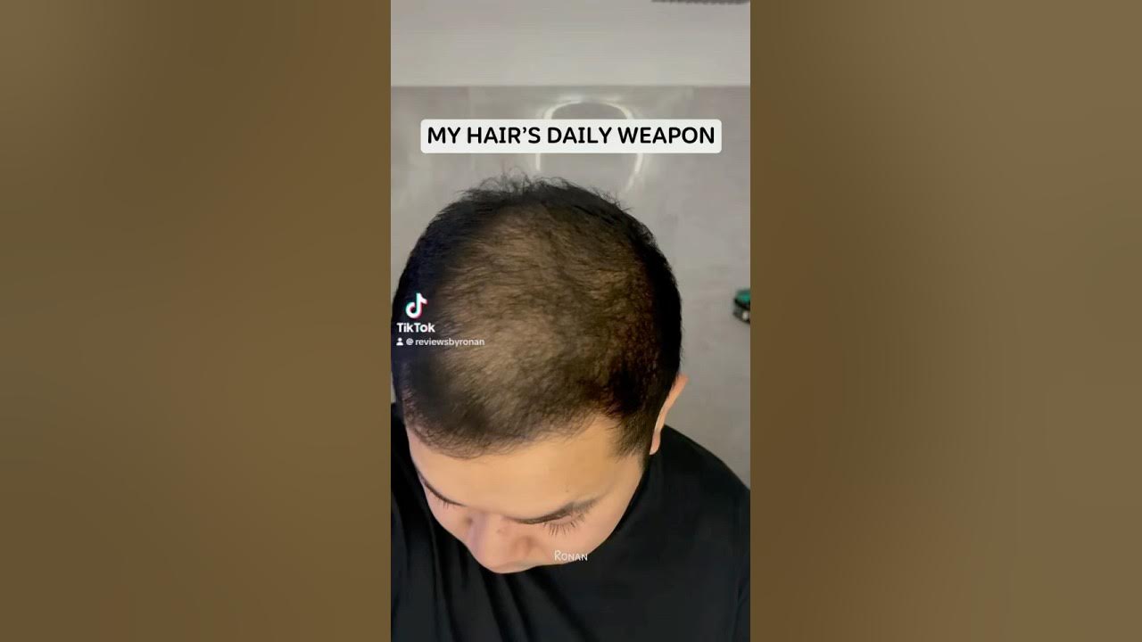 My Hair’s Daily Weapon! Toppik Hair Fiber Powder & Applicator My Hair’s Daily Weapon! Toppik Hair Fiber Powder & Applicator