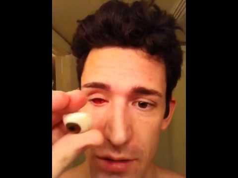Fake eye taken out - YouTube