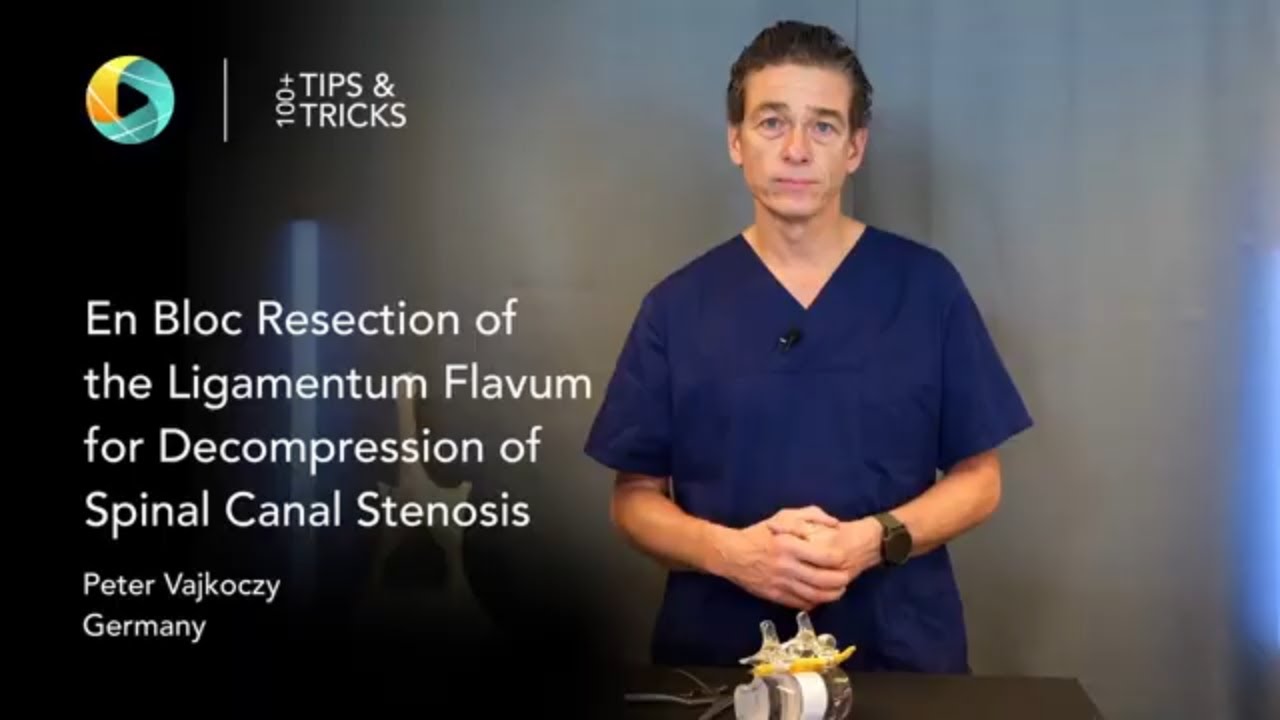 Блоковая резекция желтой связки для декомпрессии спинномозгового канала по Вайкоци 