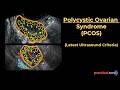 Normal Ovary Vs PCOS |Criteria, Reporting & Common Pitfalls