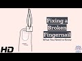 Broken Fingernail Remedies: Get Your Nails Back in Shape