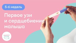 5-6 недель. Первое узи и сердцебиение малыша