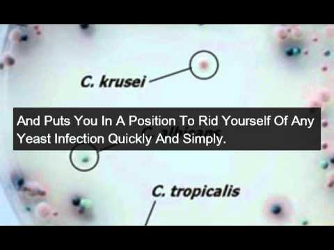 Penis Yeast Infections - YouTube