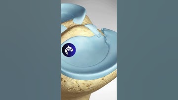 See how a Meniscus Root Repair of the Knee works - 3D animation #meniscus