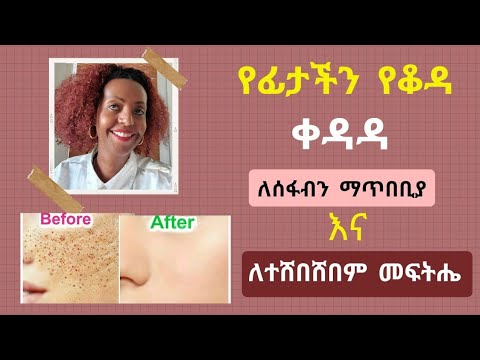 ቪዲዮ: ጠቃጠቆ የሜንዴሊያን ባህሪ ነው?