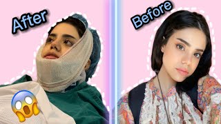 إزالة ورم وخمس ضروس!!! SURGERY VLOG