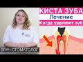 Киста зуба - лечение и удаление кисты зуба. Цистотомия, цистэктомия, удаление зуба при кисте.