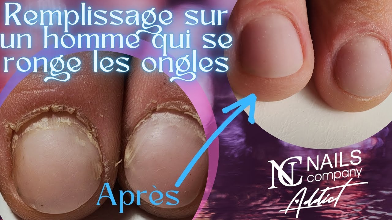 Les HOMMES aussi peuvent porter DU GEL (reconstitution des ongles — free download