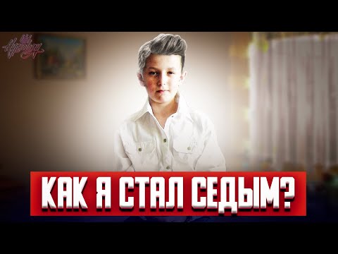 Уже в 11 лет я стал седым! Что произошло?