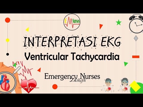 Ventricular Tachycardia, VT