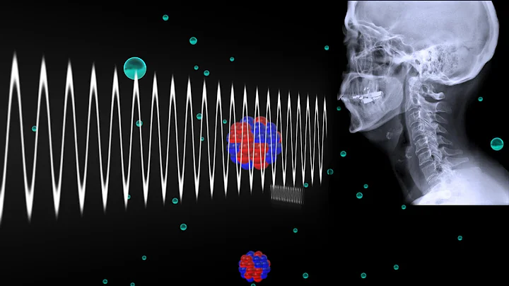 How Do X-rays Work? - DayDayNews