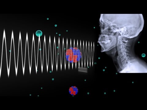 Video: Razele X au folosit radiații ionizante?