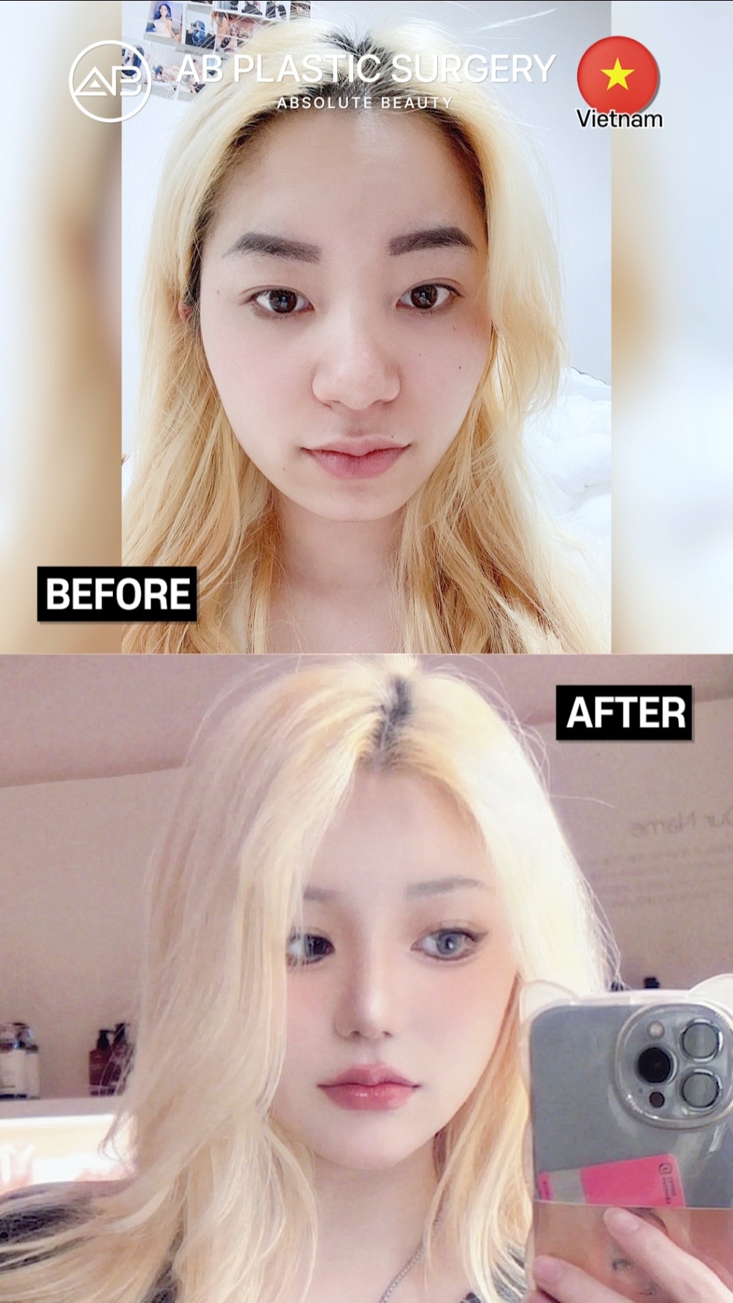 The Most Unbelievable Glow-Up Transformation #shorts