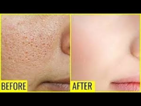 How to Apply Skin Whitening Rice Flour & Turmeric with Dutchie Yogurt Anti-Aging Secret