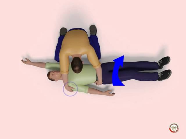 Первая помощь при травматическом шоке