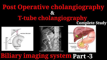 T-tube cholangiography / Post operative cholangiography ## Biliary imaging system part -3 #*#