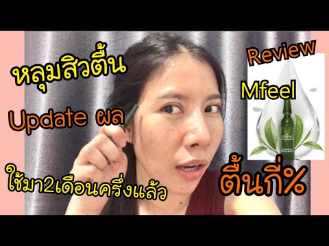 Review Mfeel #เซรั่มหลุมสิวตื้น : มาอัพเดตตามนัดค๊า ใช้มา 2 เดือนครึ่ง ตื้นขึ้นแค่ไหน