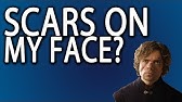 How to get rid on chemical burns ( on face ) - YouTube