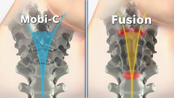 Mobi-C vs Fusion Animation Video