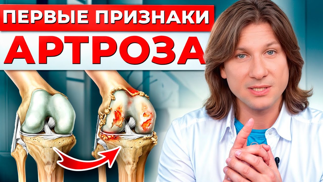 СПАСИ СУСТАВЫ ПОКА НЕ ПОЗДНО! / Как распознать и вылечить артроз на РАННЕЙ стадии?