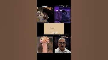 relatable?👽#boostalgorithm #madsthetic #shortsviral #fpyシviral #fypシ゚viral #aestheic #relatable