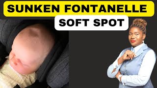 Causes and Treatment of a Sunken Fontanel and Soft Spot | Fontanelle screenshot 4