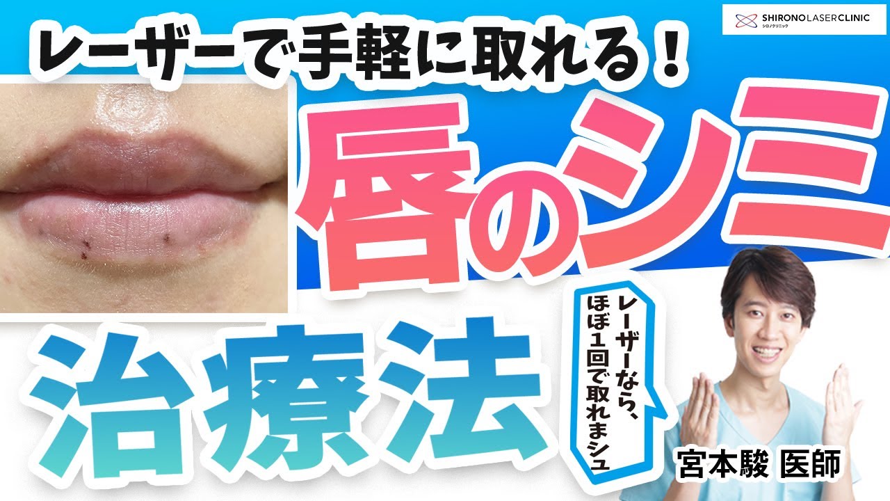 唇のシミをレーザーで簡単除去！