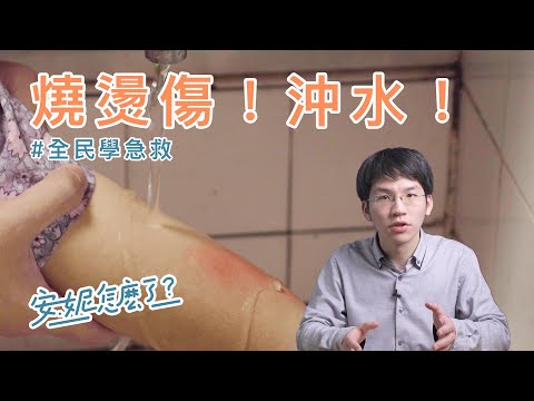 F10-1 燒燙傷立即沖水才是最重要的！ —全民學急救