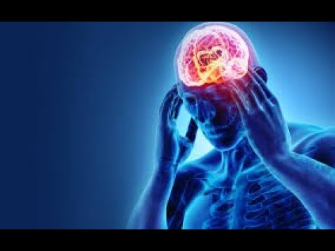 Different Headache Types, Causes and 15 Natural Remedies