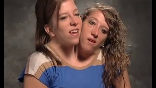 Abby and Brittany - The Amazing Life Of Conjoined Twins ! by 10listings 8,849 views 9 years ago 2 minutes, 2 seconds