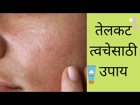 तेलकट त्वचेसाठी उपाय |Oily Skin Problem Solution In Marathi| Skin Care In Marathi